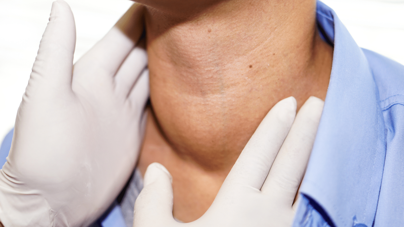 Pescoço de paciente com inchaço visível sendo examinado por médico, indicando possível hipertireoidismo
